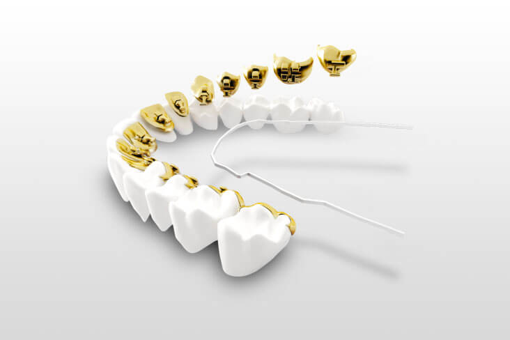 ortodoncia jerez