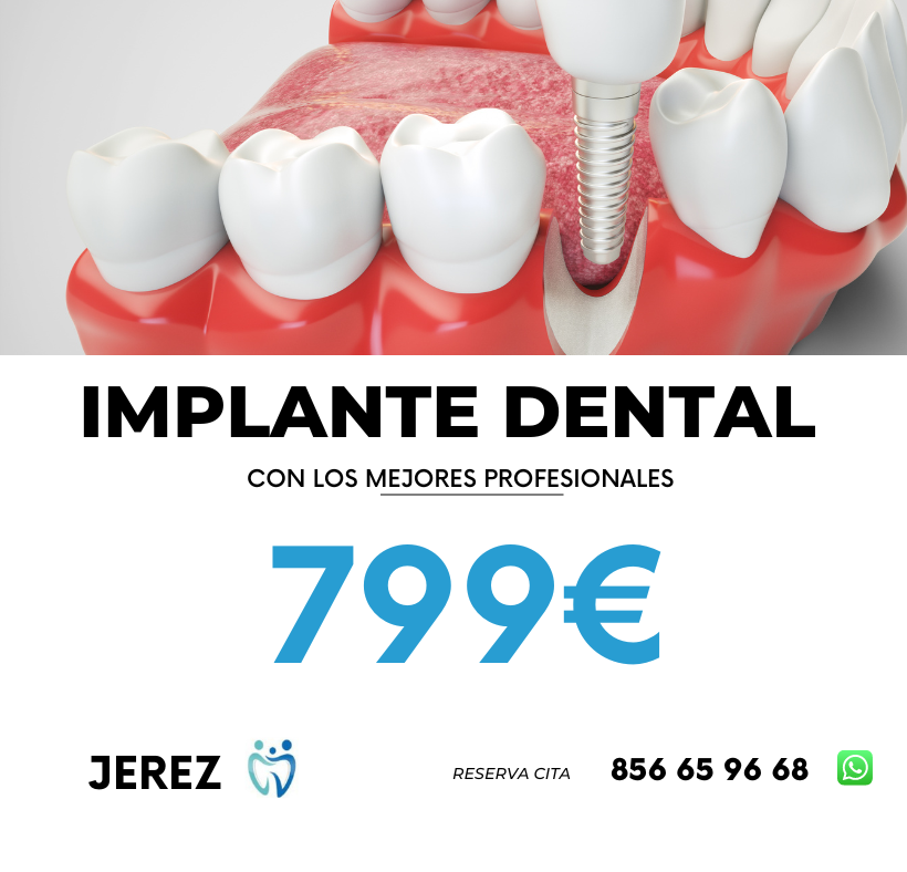 Oferta implante dental