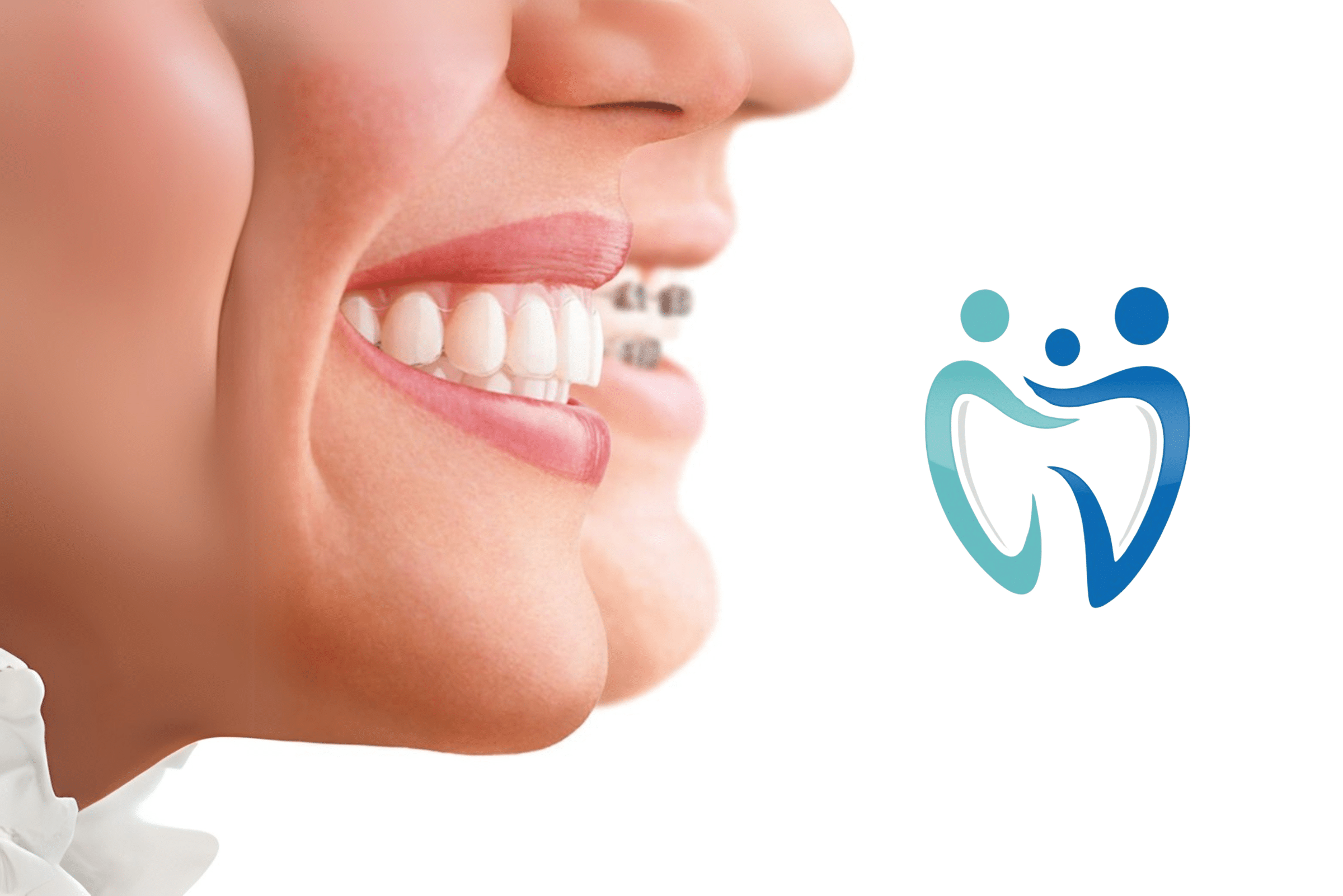 Ortodoncia invisible en Jerez